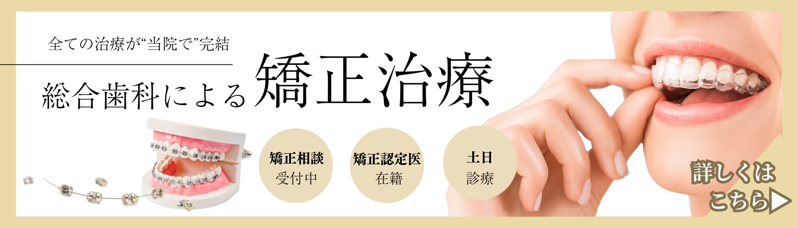 マウスピース矯正